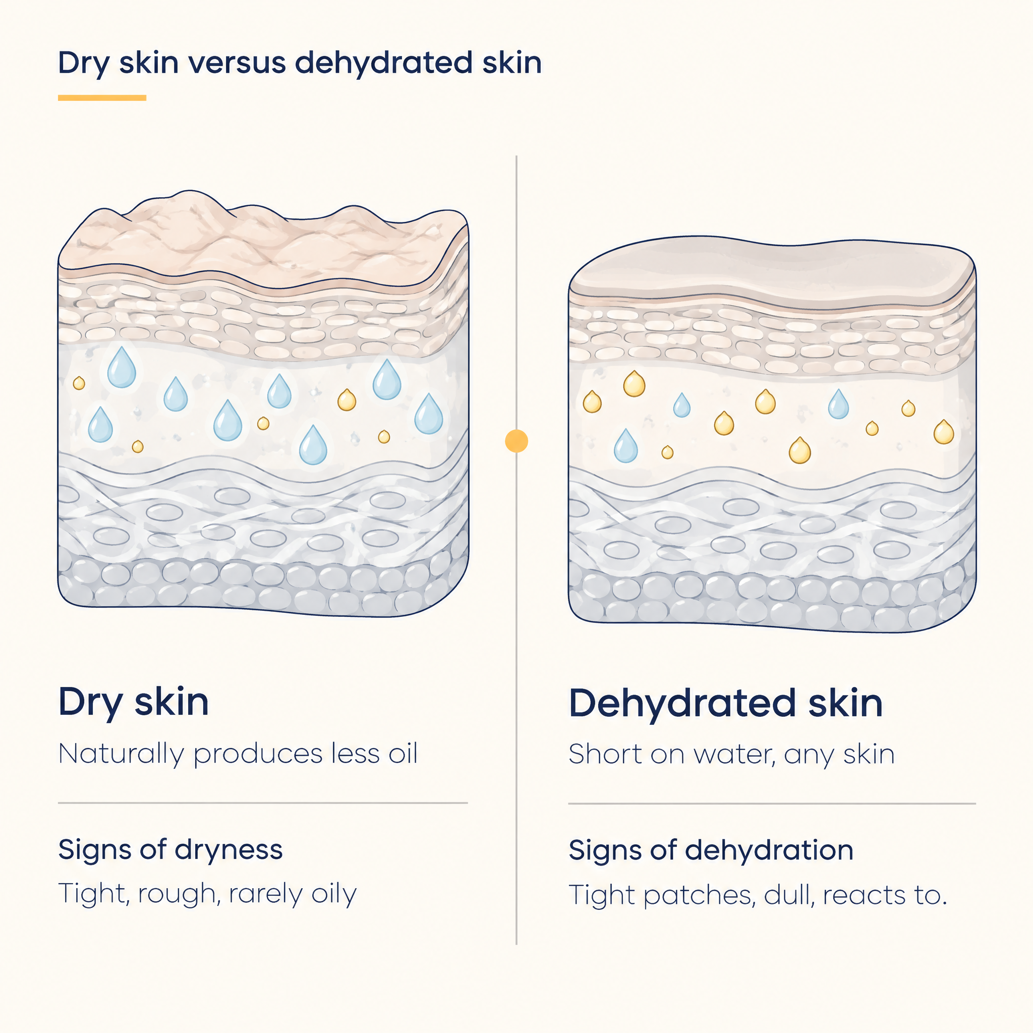Comparison diagram contrasting signs of dry skin against signs of dehydrated skin.
