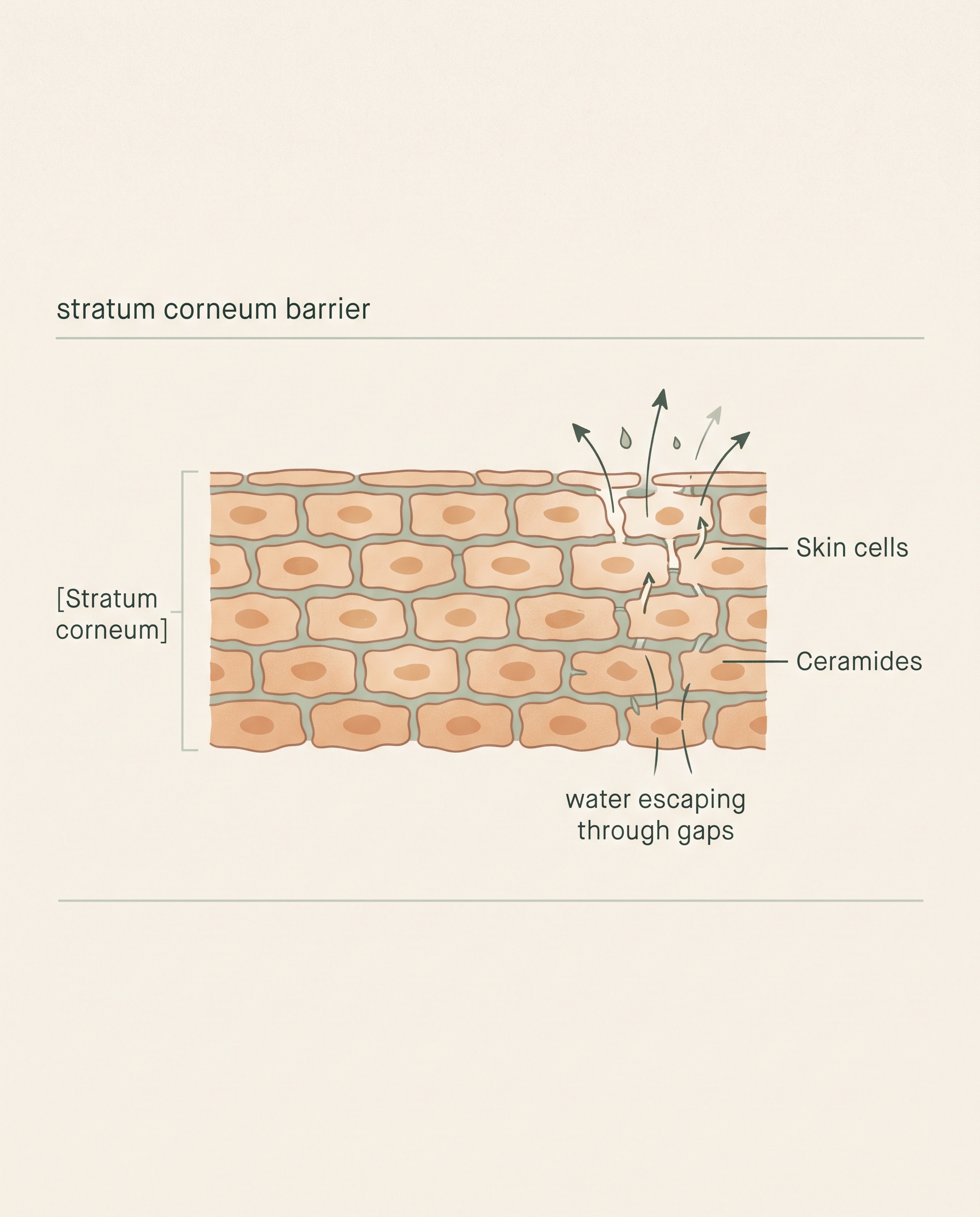 Diagram of skin barrier showing stratum corneum, ceramides, and water loss through weakened areas
