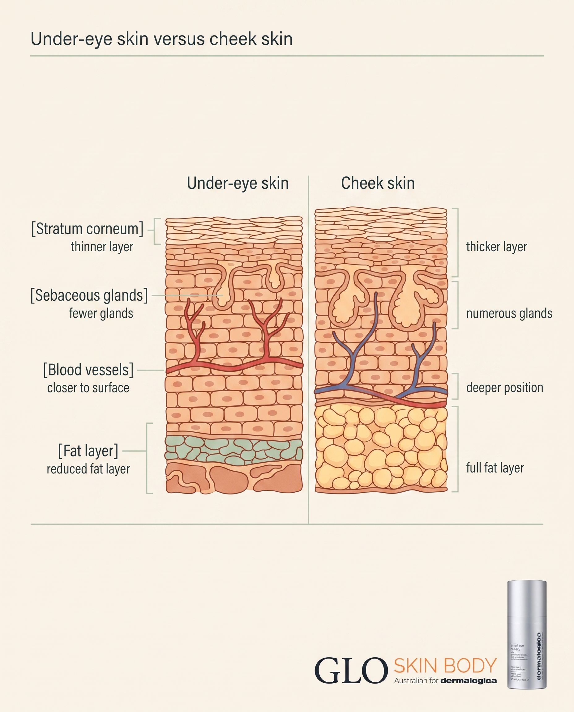 Diagram comparing under-eye skin structure to facial skin, showing thinner layers and fewer oil glands.
