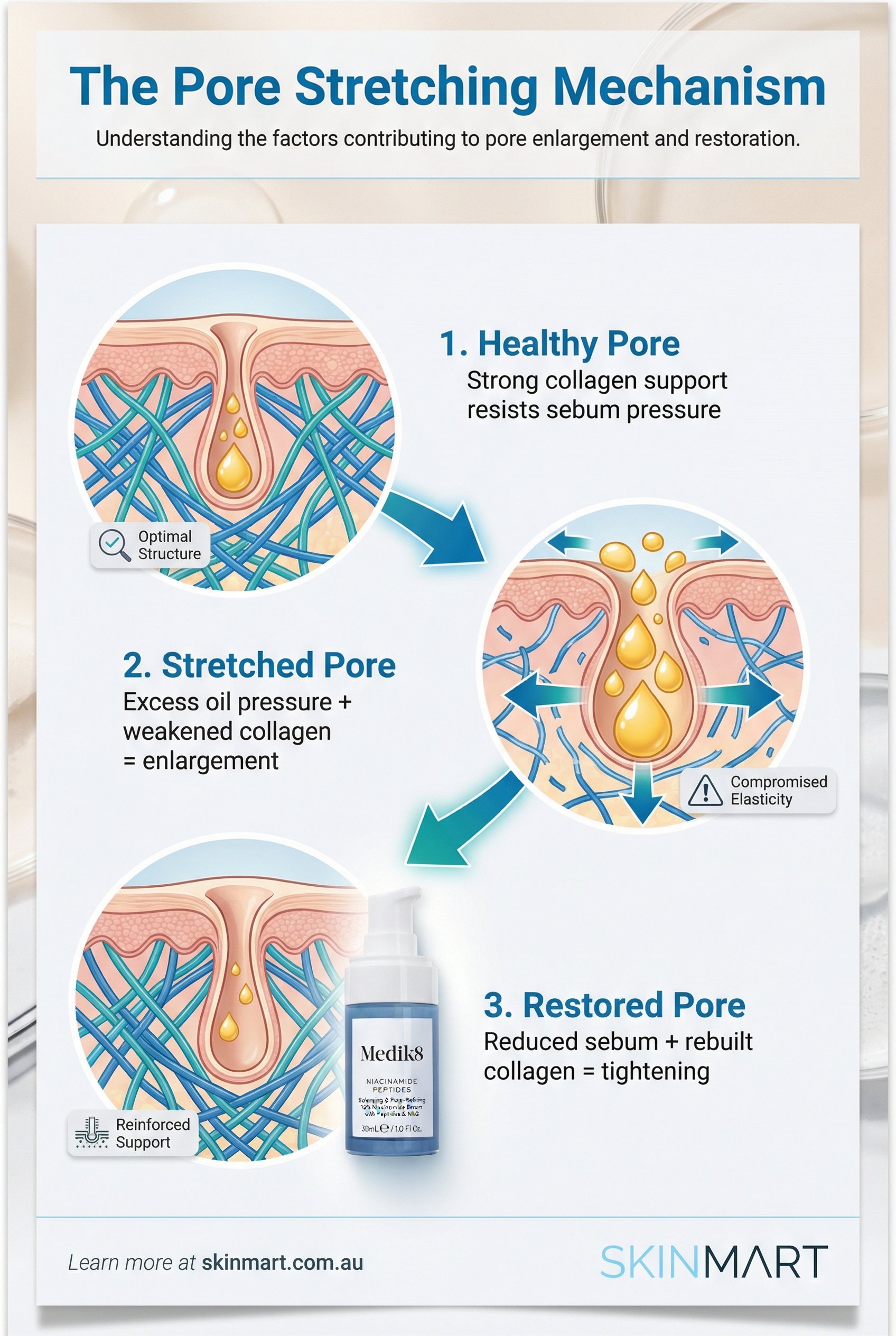 Educational diagram showing three cross-sections of skin pores: healthy pore with intact collagen, stretched pore with excess sebum and weakened collagen, and restored pore with reduced oil and rebuilt support structure