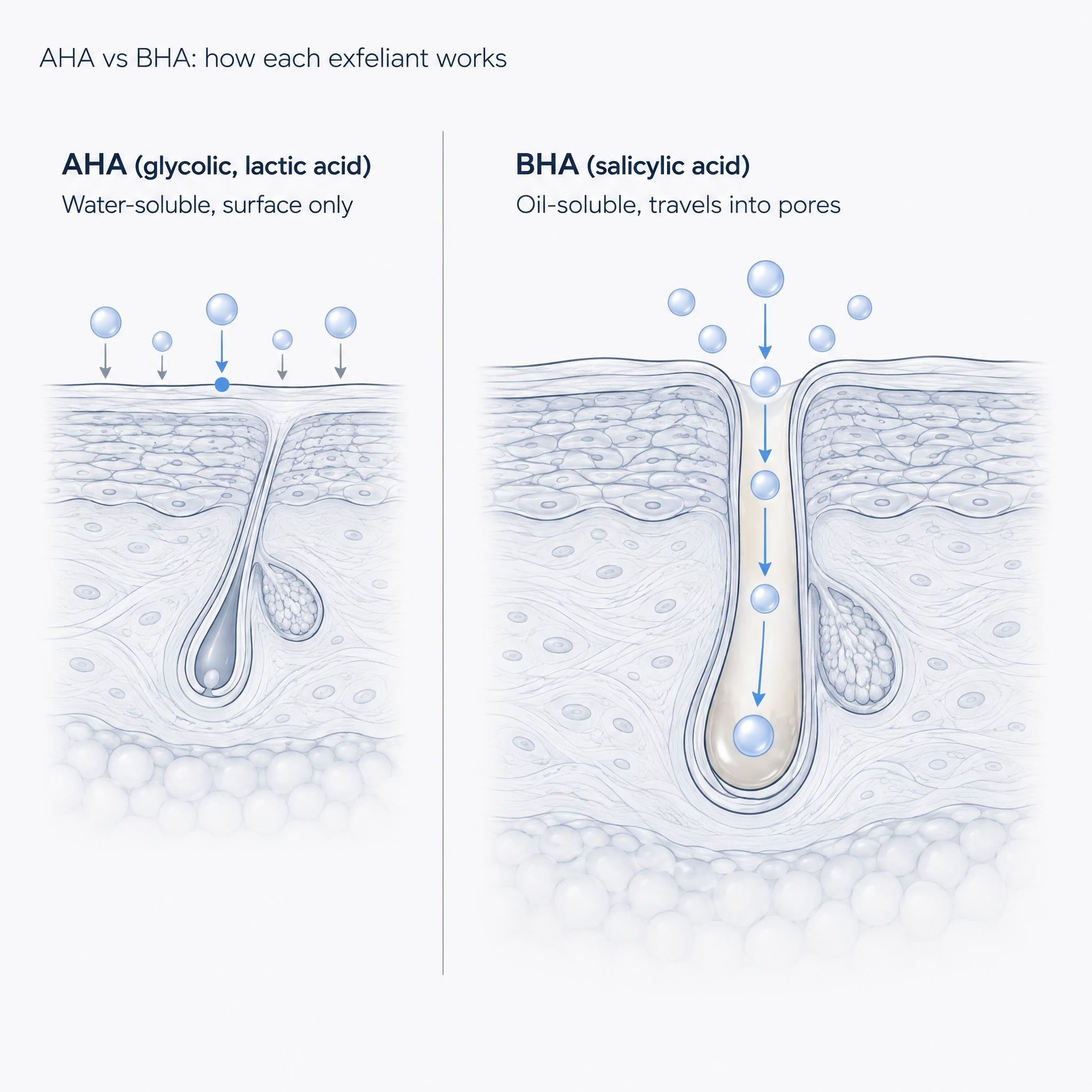 Comparison diagram of AHA versus BHA exfoliation mechanisms
