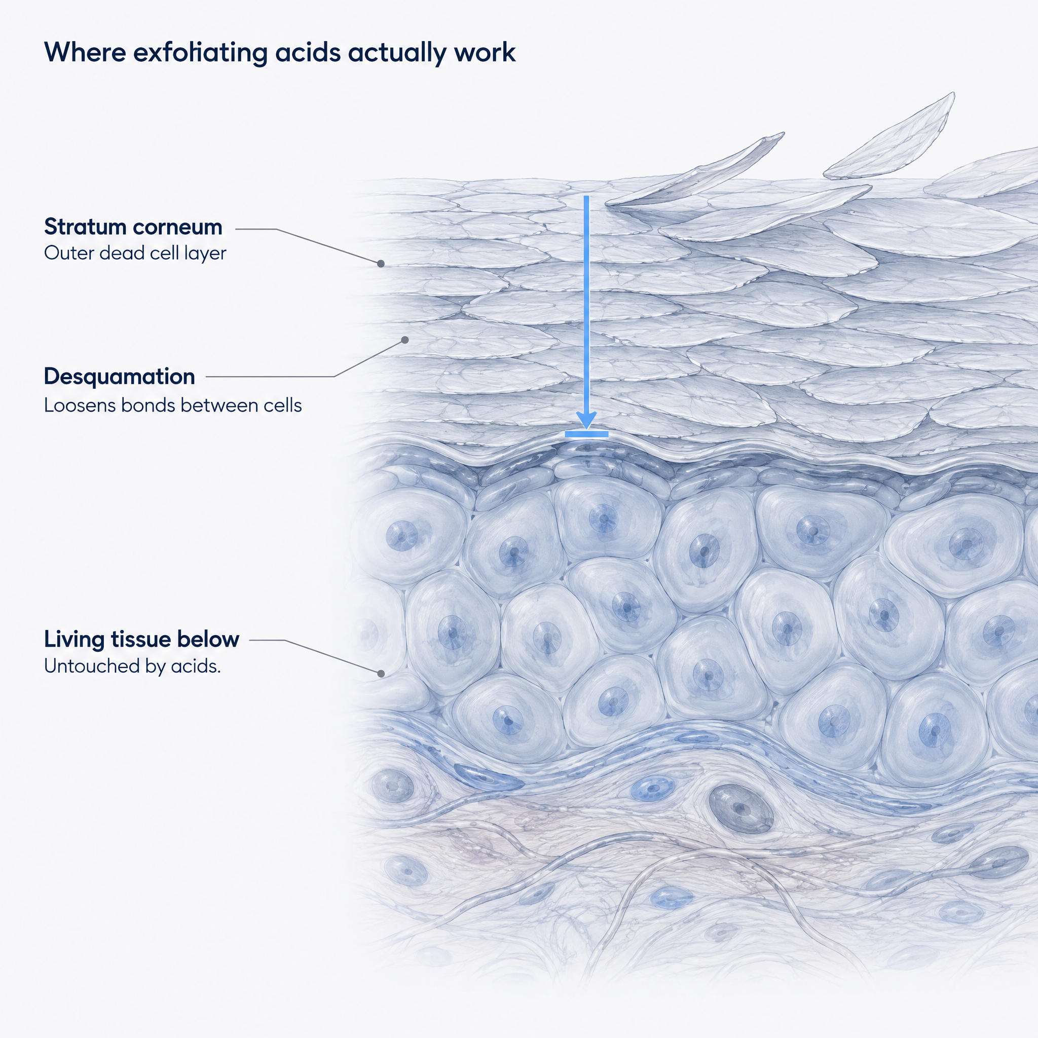 Cross-section diagram showing acids acting on the skin's outer dead cell layer