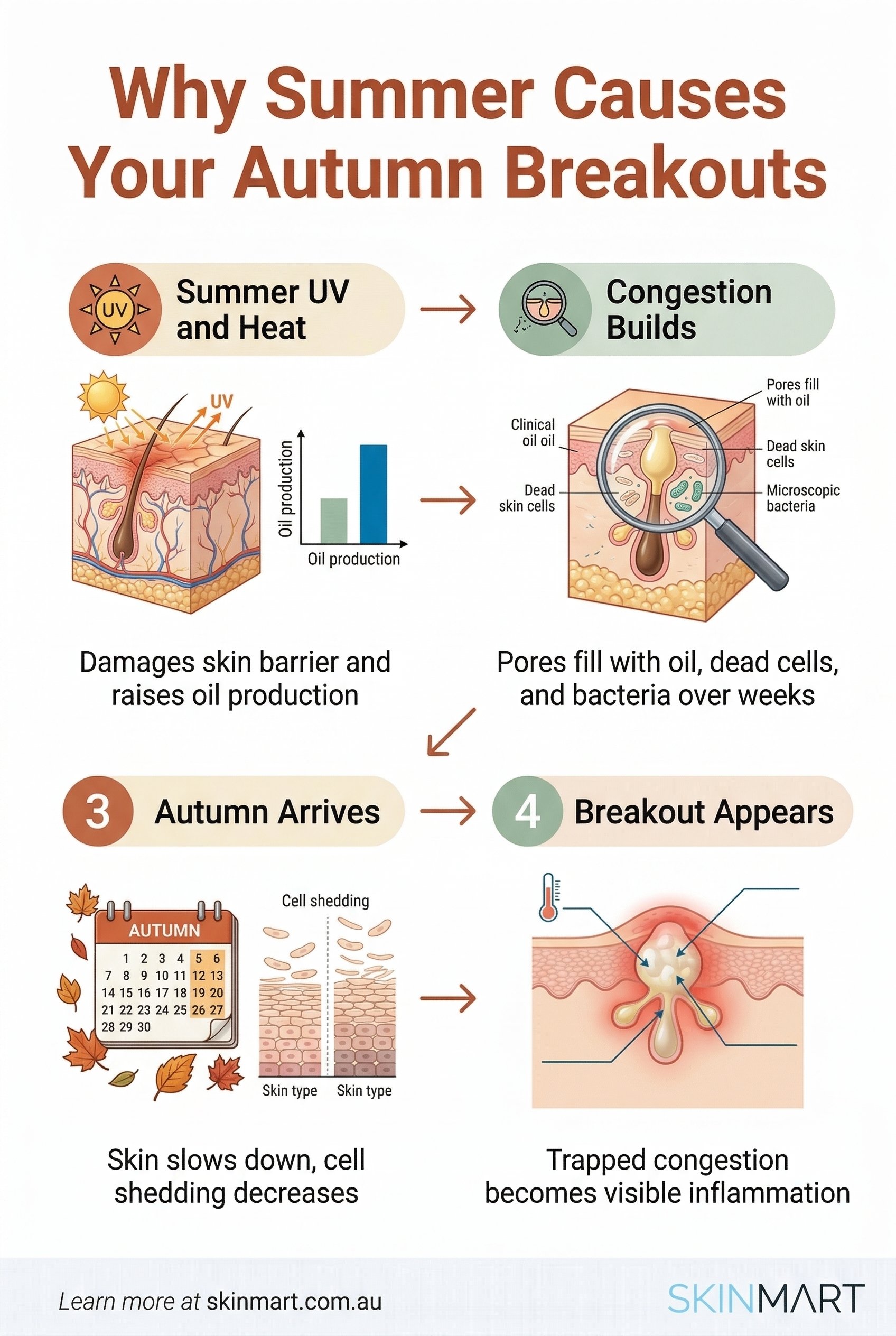 Infographic showing a four-step timeline: Step 1 Summer UV damages barrier, Step 2 Congestion builds in pores, Step 3 Autumn slows cell shedding, Step 4 Delayed breakouts appear as trapped congestion inflames