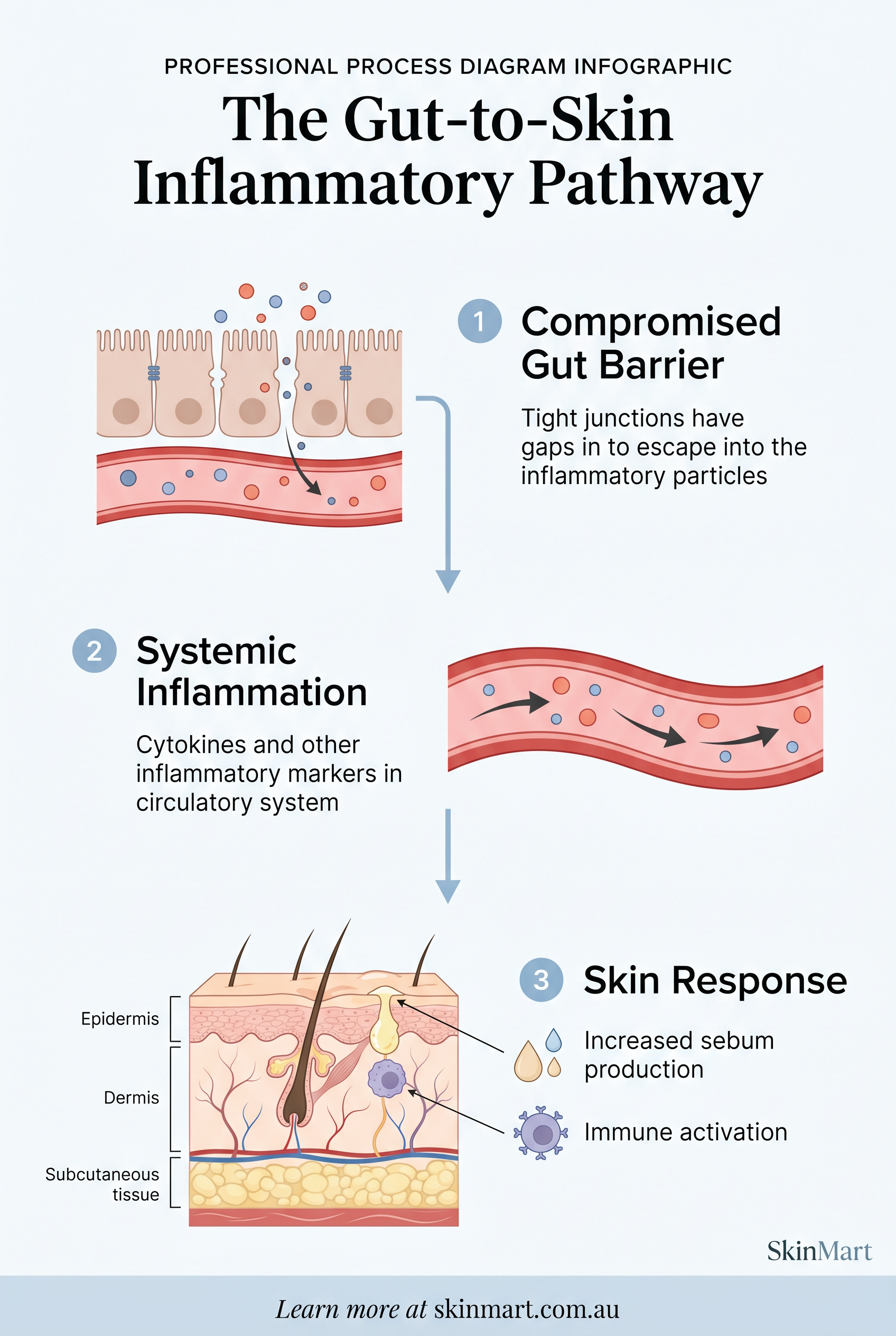 Infographic diagram showing inflammatory pathway from compromised gut barrier through bloodstream to skin, with labeled arrows indicating cytokines and immune responses