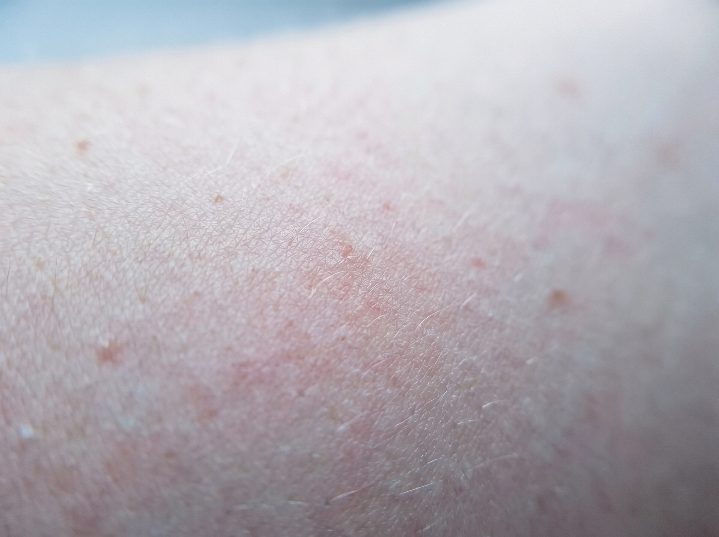 Extreme close-up macro photograph of fair skin surface showing fine texture and subtle diffuse redness in soft natural light