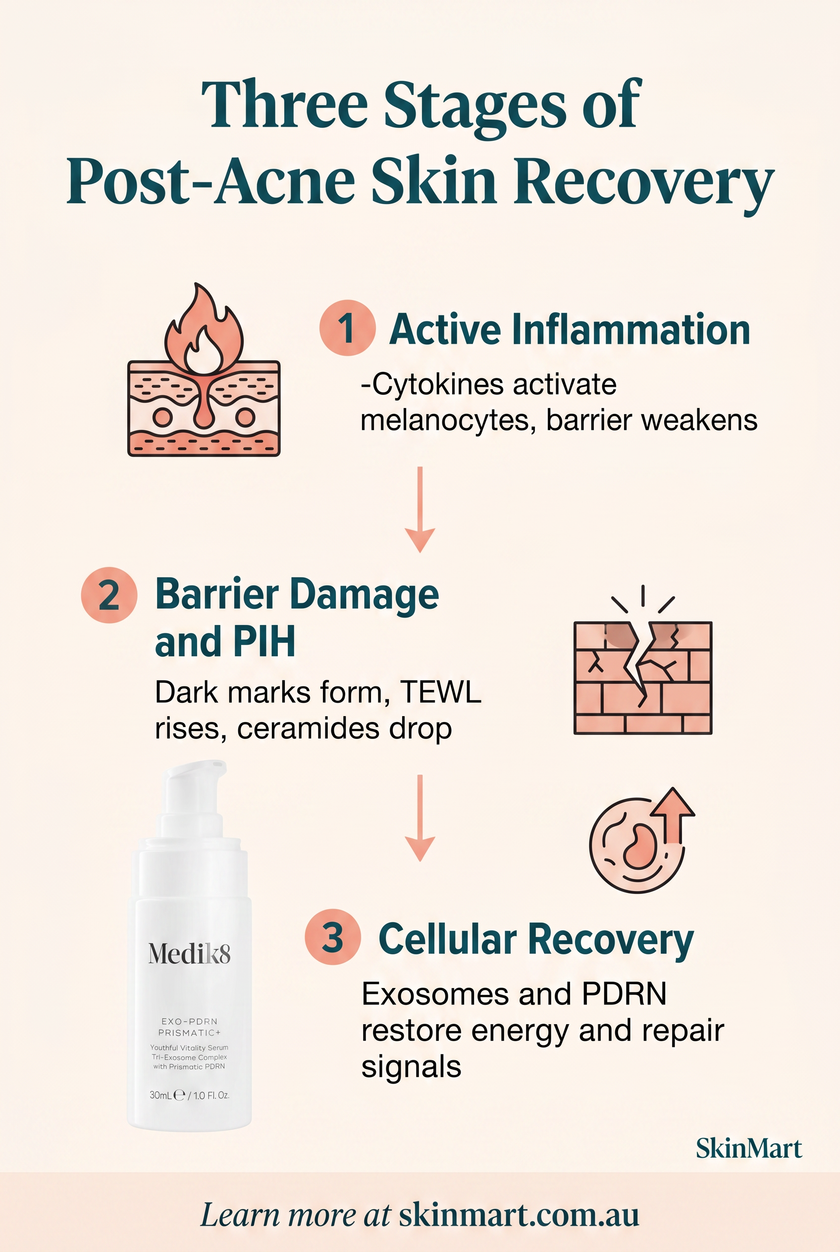 Infographic showing three stages of post-acne skin: active inflammation with cytokine release, barrier damage and PIH formation, and cellular recovery supported by exosomes and PDRN