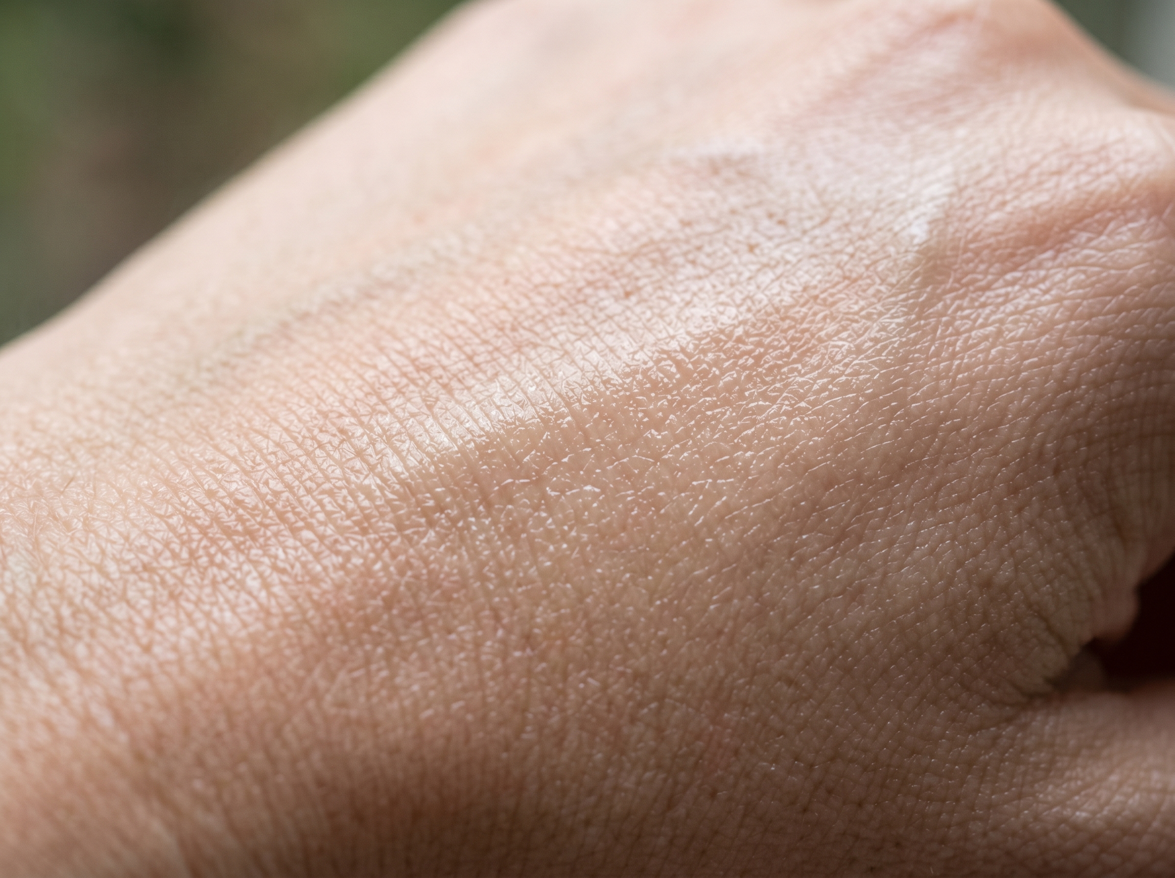 Close-up of smooth, hydrated skin texture representing an intact moisture barrier
