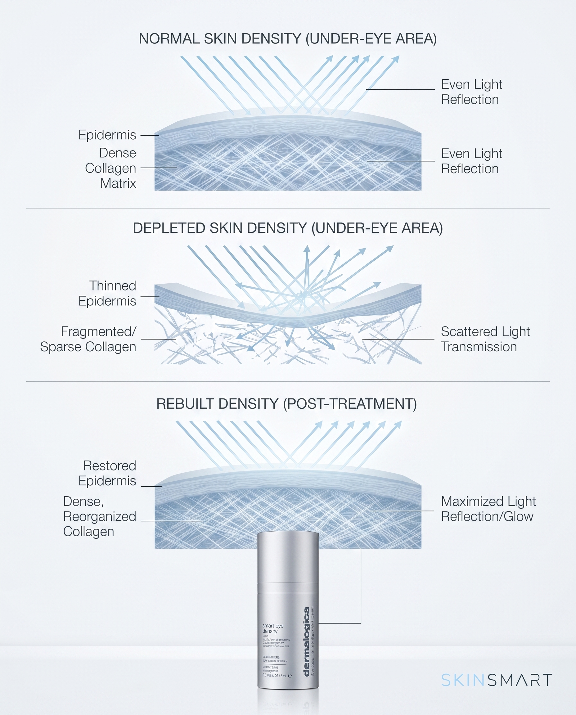 Diagram comparing dense skin reflecting light evenly versus depleted skin scattering light, causing dullness