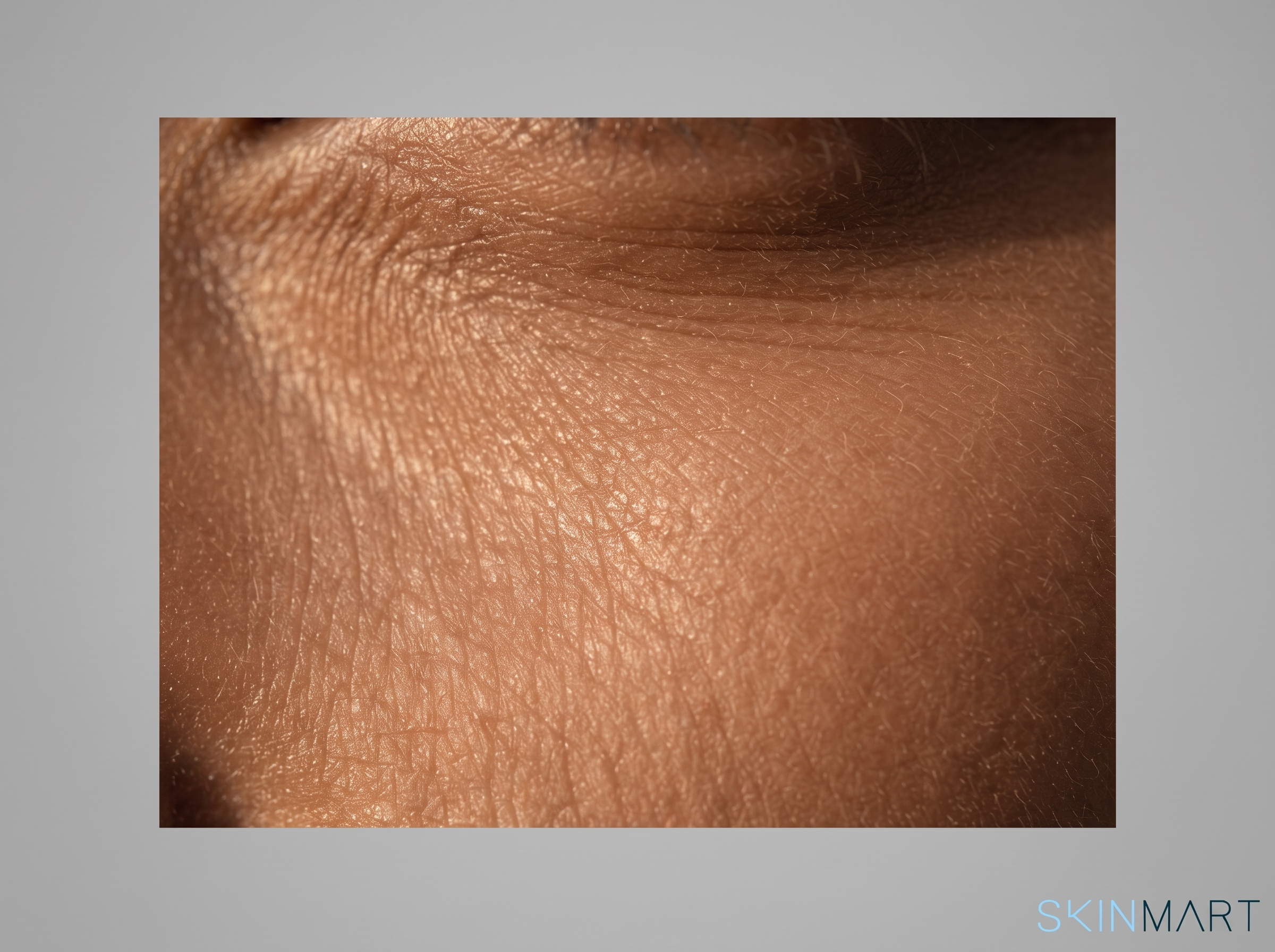 Close-up macro of delicate skin texture showing fine surface lines in soft directional light