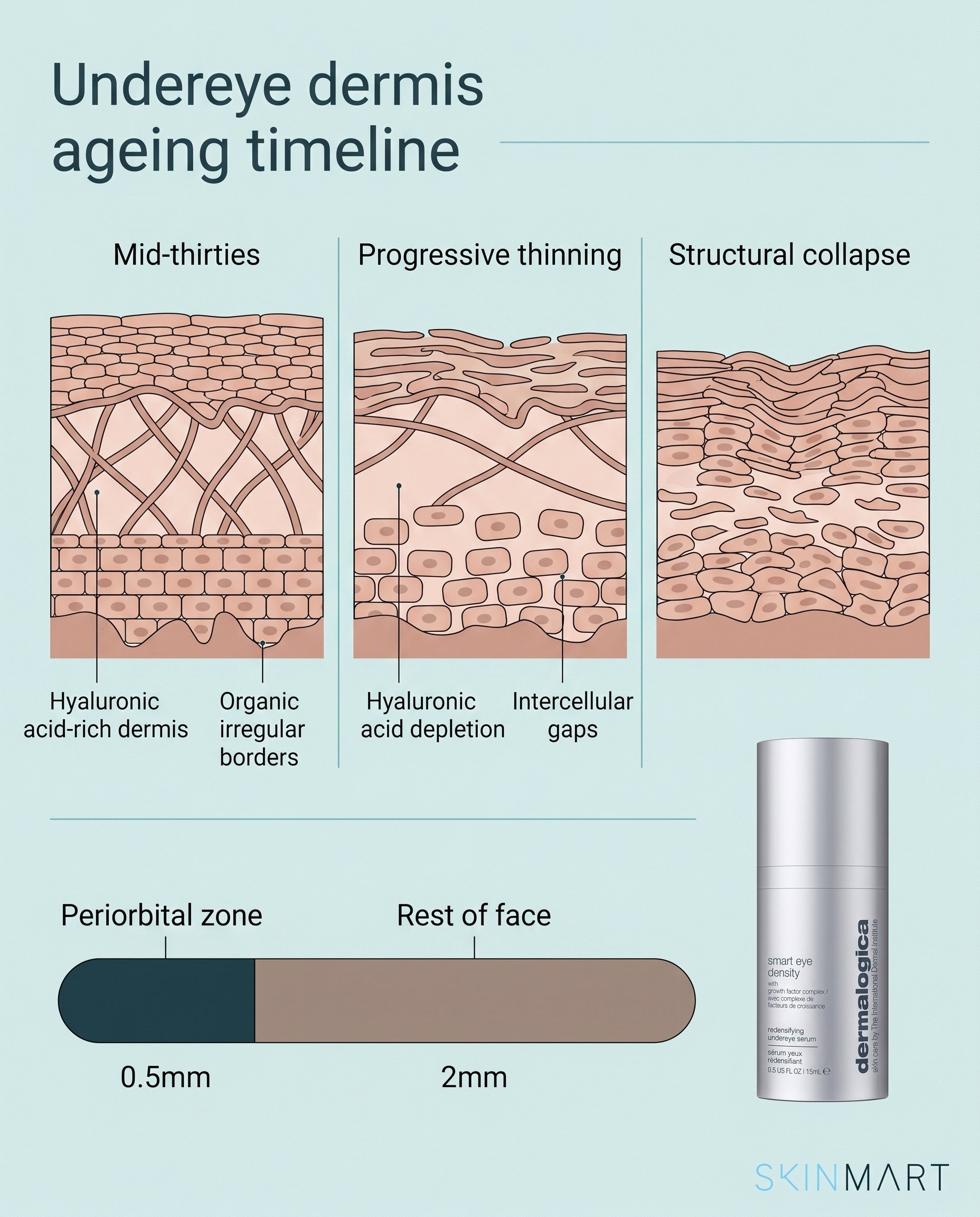Timeline graphic showing how collagen and hyaluronic acid decline in the undereye area from the mid-thirties onward